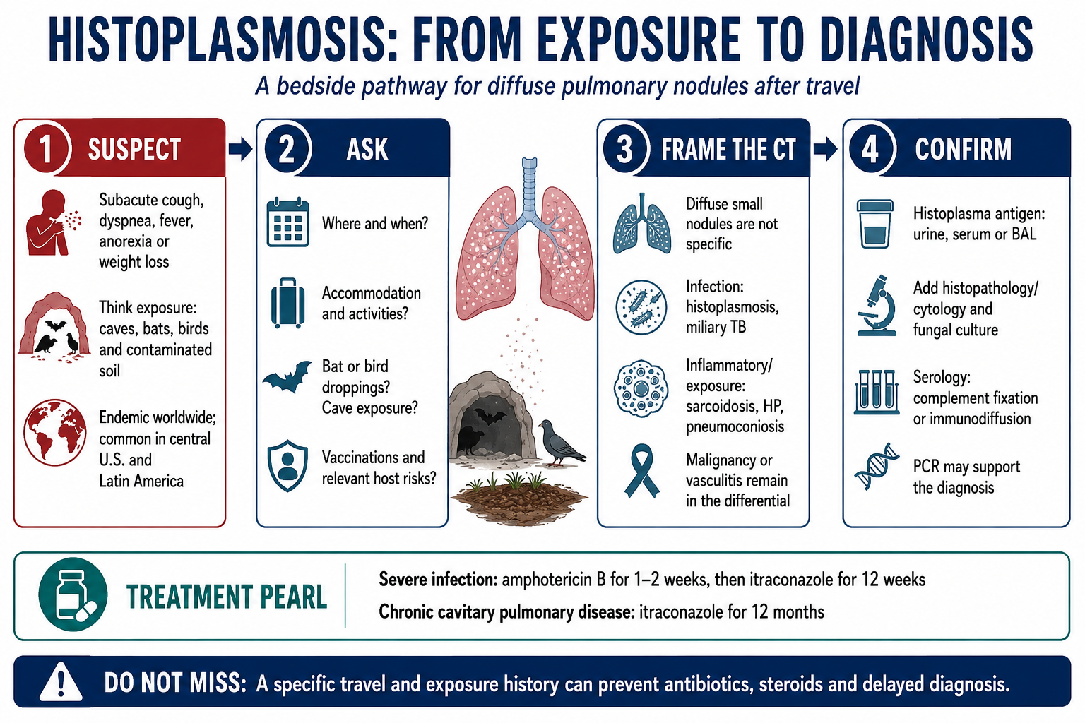 Histoplasmosis educational overview